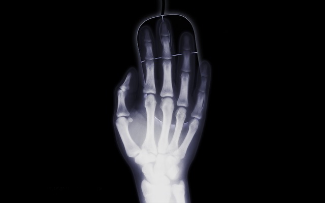 rentgenový snímek